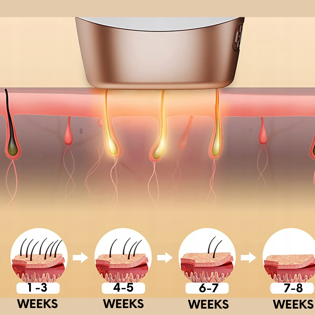 ZENNflow™  ZF1 IPL laser Hair Removal